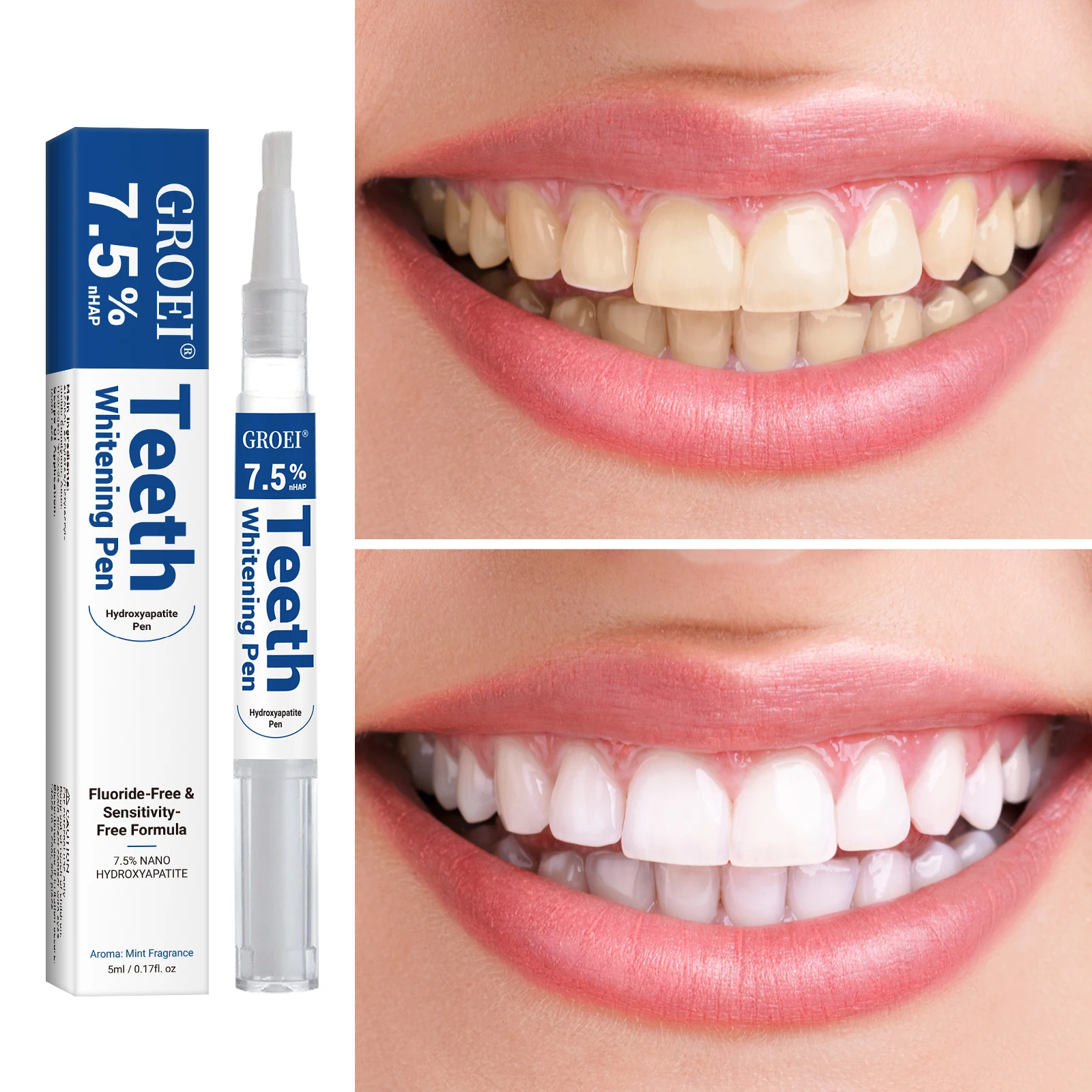 Caneta branqueadora de dente h - Teeth Whitening Gel Pen avaliação e preço