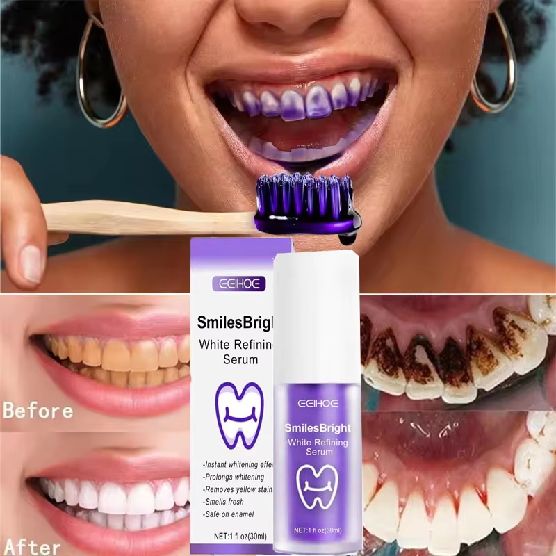 Pasta de Dente Clareadora e Ge - Teeth Whitening In Korea avaliação e preço