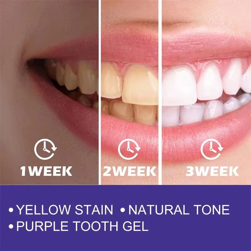 Pasta de Dente Clareadora e Ge - Teeth Whitening In Korea avaliação e preço
