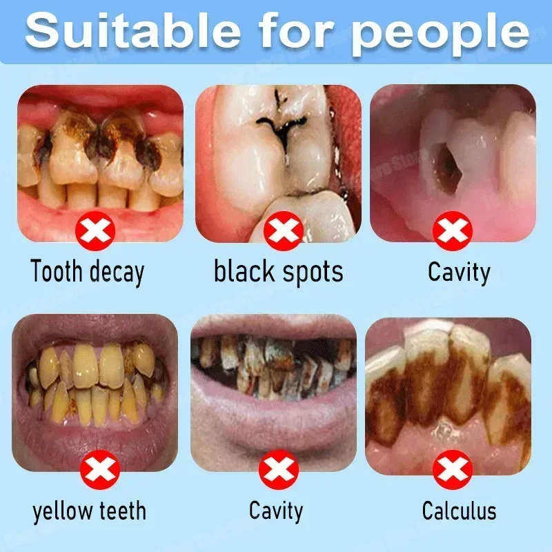 Pasta de Dente Anticáries: Rep - Remineralizing Toothpaste avaliação e preço