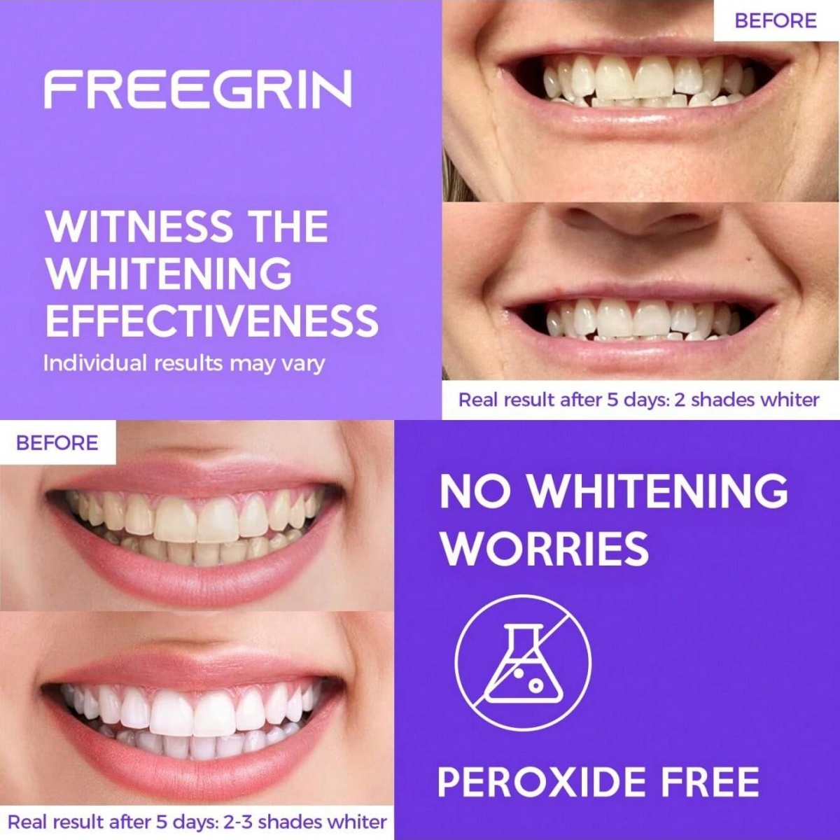 Adesivos de clareamento dental - Teeth Whitening Remedies avaliação e preço